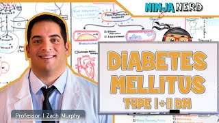 What is the Difference Between Type I and Type II Diabetes Mellitus | High Yield
