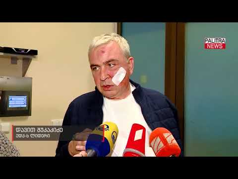 დავით შუკაკიძეზე თავდასხმის გამოძიება ჯგუფურად ცემის მუხლით დაიწყო