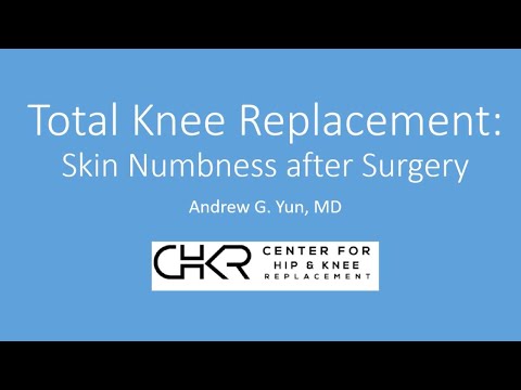 Total Knee Replacement: