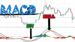 HOW TO USE MACD . MACD KYA HAI. MACD KA USE KAISE KARE . VIP INDICATOR FOR CHART MACD. WHAT IS MACD. screenshot 5
