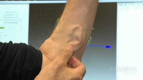 Ear Man | 9 News Perth