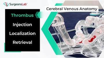 CVST Endovascular Aspiration Training with SurgeonsLab’s Transparent Model