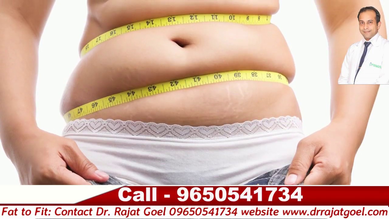 Bariatric Surgery Weight Loss Surgery in Delhi YouTube