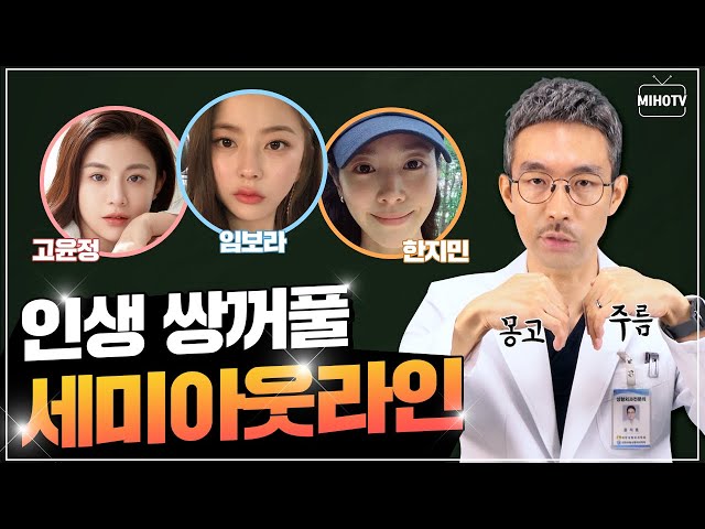 [눈성형] 세미아웃라인 잘 되는 눈이 따로 있다!? (feat. 세미아웃라인이 어울리는 연예인)