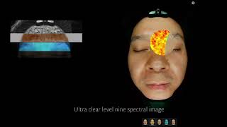 3d Skin Analysis Machine