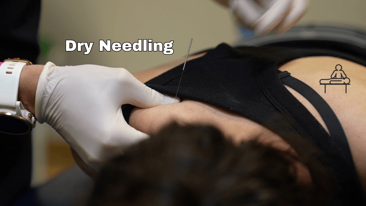 Dry Needling for a Twitch Response