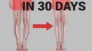 Get Straight Legs in 30 Days! Fix O or X-Shaped Legs (Knee Internal Rotation) screenshot 2