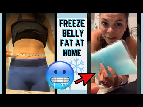 Video: Coolsculpting At Home: Hoe Het Je Kan Schaden