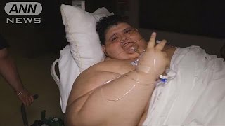 体重590キロ超の男性、命を懸けた手術に挑む(17/05/12)