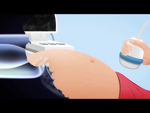 2D/3D видео за образната диагностика в инвитро оплождането