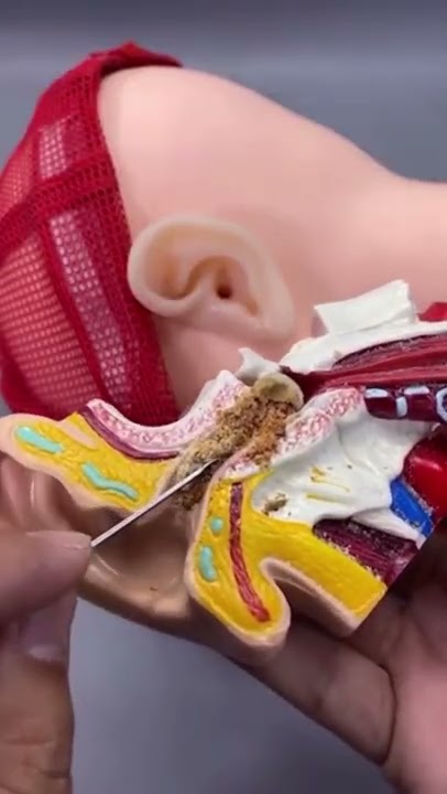 How To Clean Ear Wax Properly #shorts