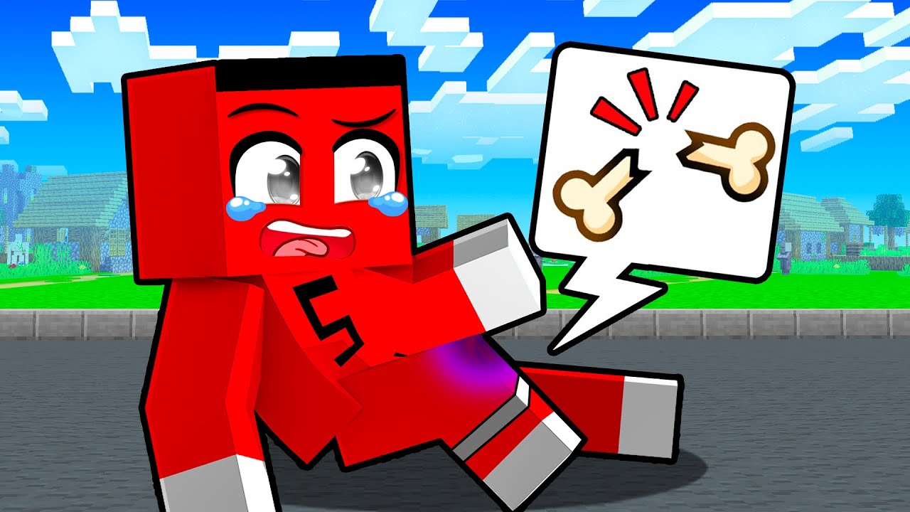 SAMET AYAĞINI KIRDI !!  - Minecraft