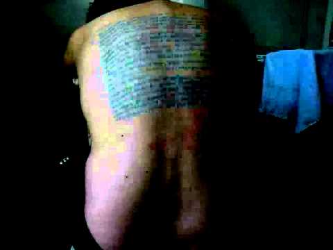 Video: Amalgam-tatoeage: Is Het Melanoom? Plus Diagnose En Behandeling