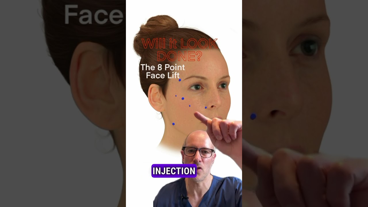 Will the 8-Point Facelift Give a “Done” Look? | Natural and Subtle Results Explained