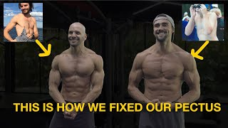 How We Fixed Our Sunken Chest Deformity with This Chest & Ab Workouts