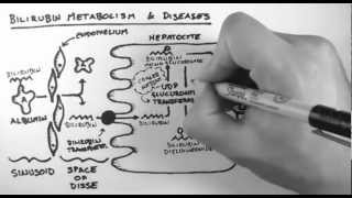 Bilirubin 2 - Bilirubin Metabolism & Diseases