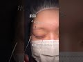 【二重整形】二重の人が整形する衝撃の理由#shorts