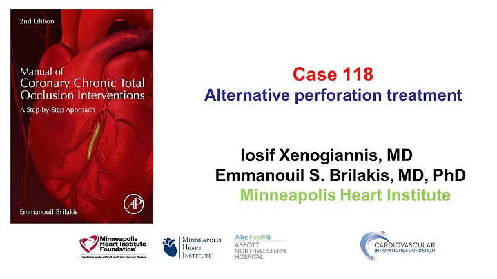 Case 118: Manual of CTO Interventions: Alternative treatment of large vessel perforation