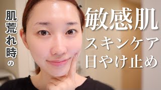 【肌荒れ】肌が敏感になってる時のスキンケア・日やけ止め