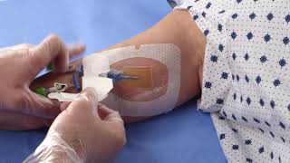 Tegaderm™ CHG (1658) - Application for PICC Video