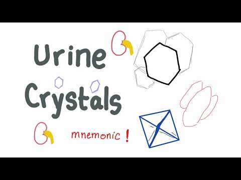 Urine Crystals (Kidney Stones) with a mnemonic