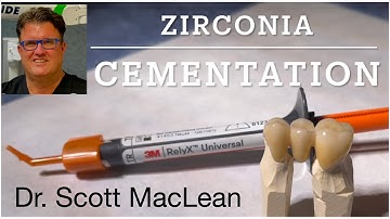 Zirconia Cementation with RelyX Universal Cement - Dr Scott MacLean - Dentist