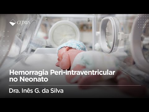 Vídeo: Isquemia Cerebral Em Recém-nascidos - Sintomas E Consequências De 1, 2 E 3 Graus