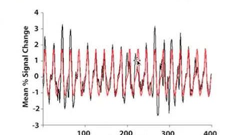 Functional MRI (fMRI)