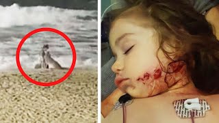 Mother of Toddler Attacked by Coyote Intends to Sue Huntington Beach