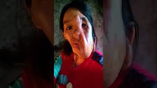 People Judged Her Because She Has One Eye But Her Reply Shocked Everyone