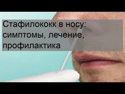 Стафилококк в носу: симптомы, лечение, профилактика