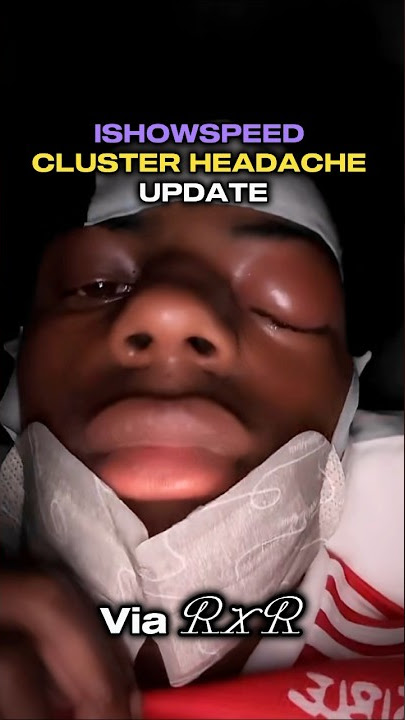 r IShowSpeed is recovering from cluster headaches, thanks fans for  their prayers