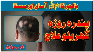 baalchar ka elaaj.بالچر کا علاج hairfalling haircare hairgrowth hairfall health hakeem