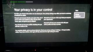 Kinect-less Xbox One First Boot, Setup, & Update