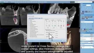 New Default Settings Dialog in Planmeca Romexis 4.0