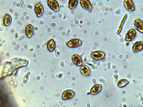 Spores Under Microscope 