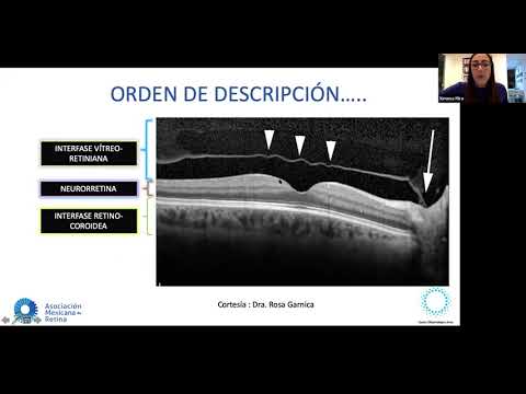 Imagen multimodal en