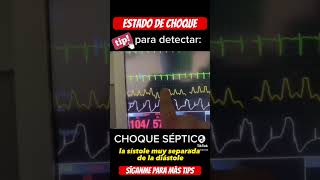 CHOQUE SÉPTICO ? emergency uci sepsis