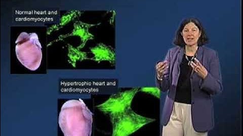 Stress Sensing - Mary Beckerle (Utah)