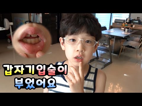 뉴욕이 입술이 붓고 물집(<strong>수포</strong>?)이 생겼어요! 복숭아? 짬뽕? 아니면 뭐가 문제였을까요? 가족 일상 브이로그 뉴욕이네