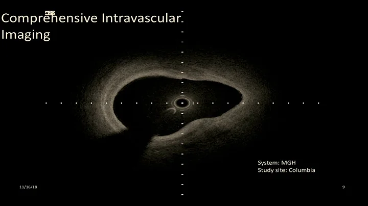 SciVizNYC 2018 Presentation: Christine Hendon