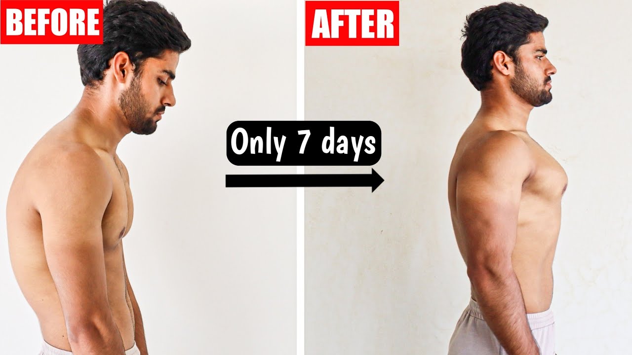 FIX ROUNDED SHOULDERS IN 1 WEEK | Fix Rounded Posture | ( 10 min/daily ...
