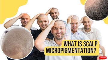 What is SMP and WHO is Scalp Micropigmentation for?