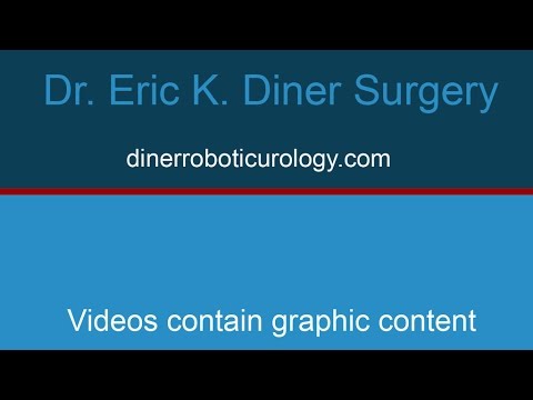 Video Of Robotic Kidney Surgery
