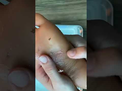 لماذا يجب عدم سحب الزجاج مباشرة السبب صادم