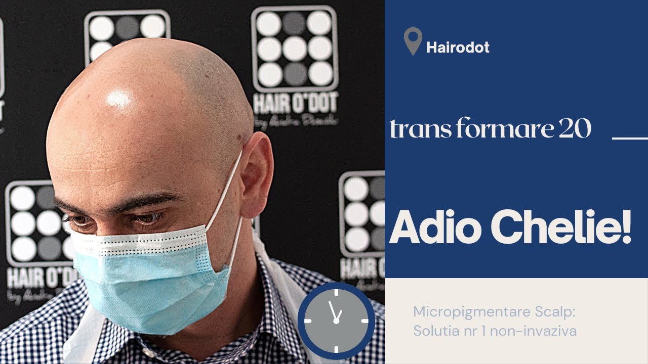 𝑨𝒅𝒊𝒐 𝑪𝒉𝒆𝒍𝒊𝒆! Micropigmentare Scalp - Hairodot