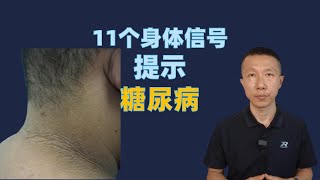 11个身体信号提示糖尿病