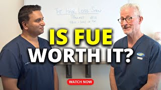 Pros and Cons of FUE Hair Transplant | The Hair Loss Show