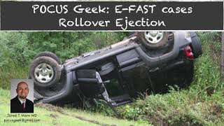 POCUS - Ejected driver from rollover at highway speeds - EFAST