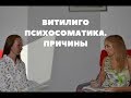 Витилиго психосоматика. Каковы причины? (Консультация психолога).